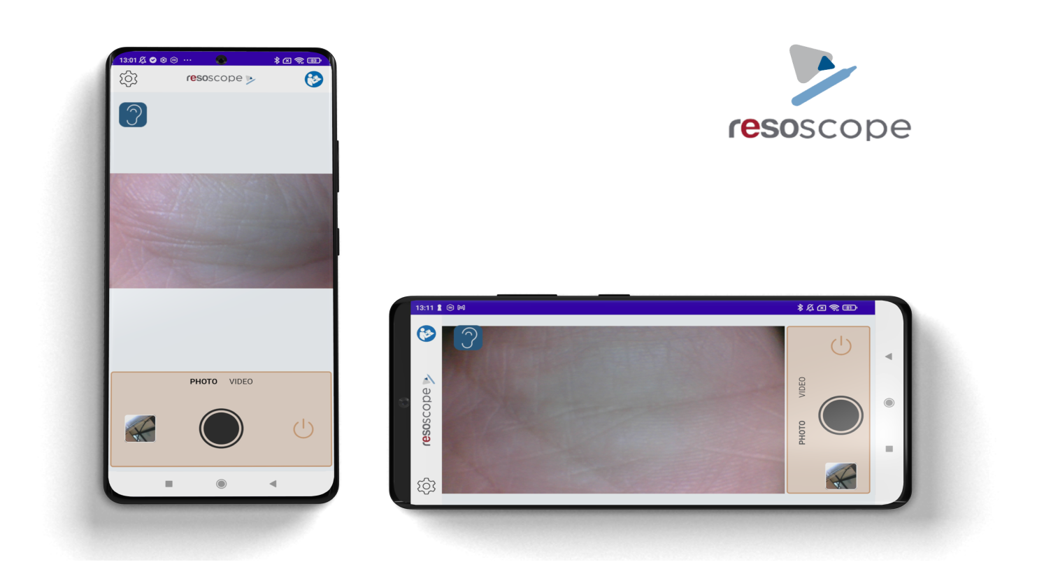Resoscope